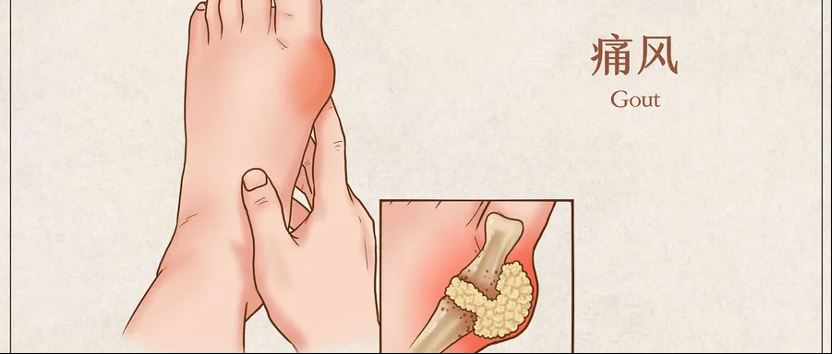 偷偷升高你尿酸的帮凶,不是海鲜、菌菇,竟然是它!图1