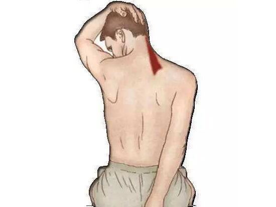 肩甲提肌拉伸 肩甲提肌拉伸