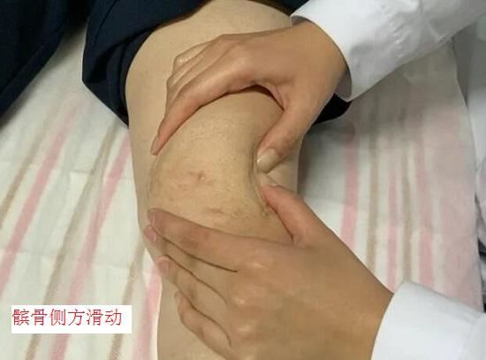 髌骨侧方滑动 髌骨侧方滑动